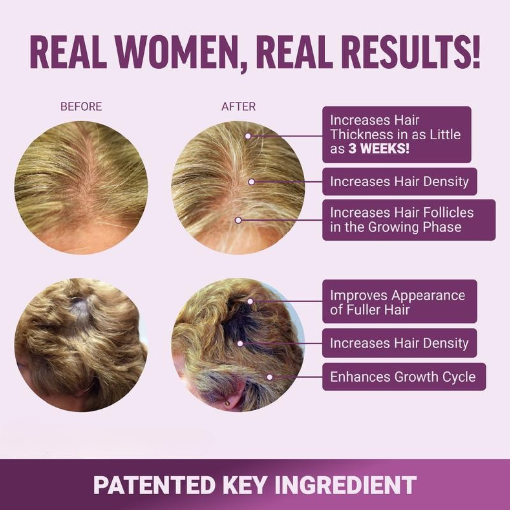 AELARA Hair Growth Accelerator
