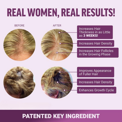 AELARA Hair Growth Accelerator