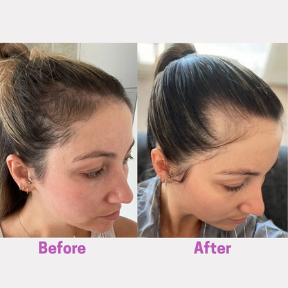 Aelara Hair Growth Accelerator