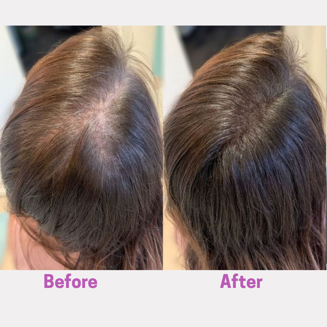 Aelara Hair Growth Accelerator